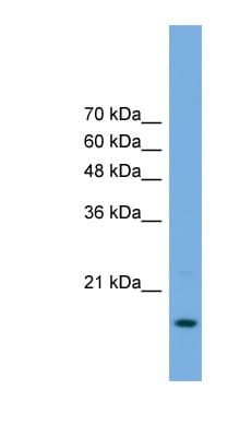 HSPC004 / POP5 Antibody (aa71-120)