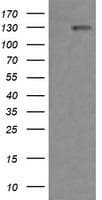 ERBB2 / HER2 Antibody (aa676-1255, clone OTI4F6, Carrier-free)