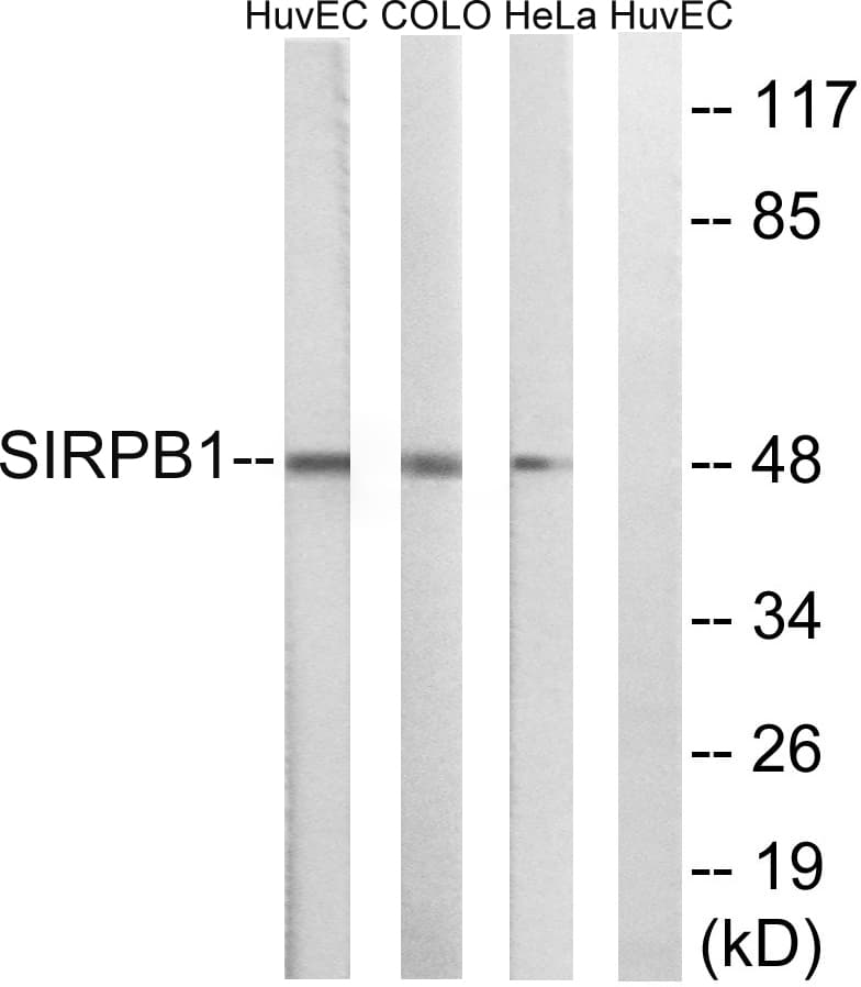 Polyclonal Rabbit anti-Human SIRPB1 / CD172b Antibody (aa231-280, WB)