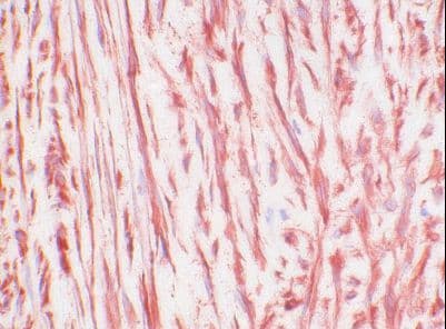 Monoclonal Mouse CTGF Antibody (clone 2154-60, IHC)