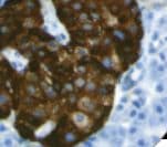 CHGA / Chromogranin A Antibody (clone LK2H10)