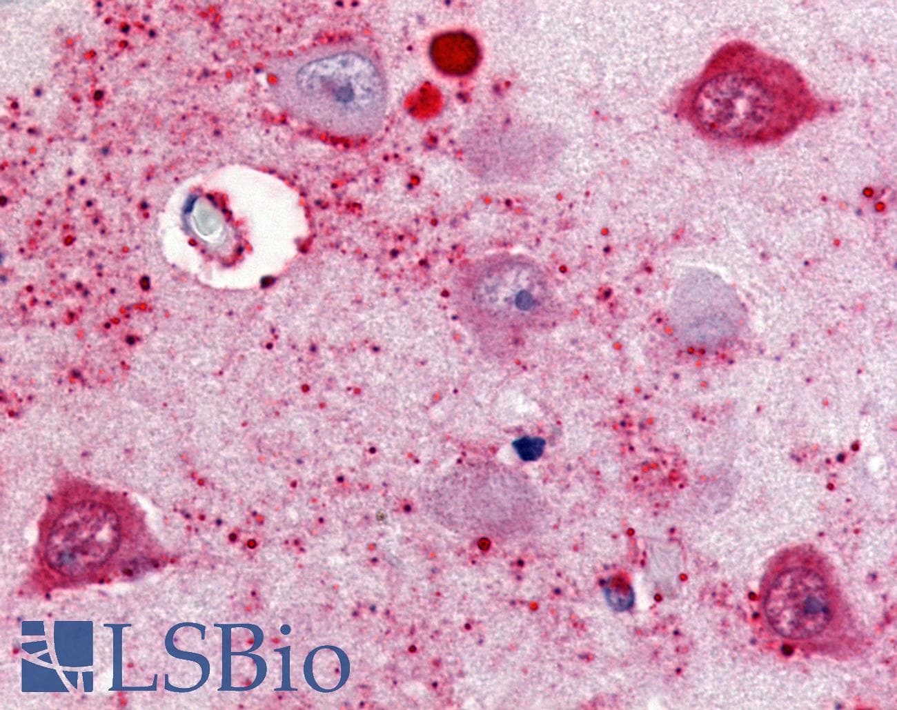 IHC-plus™ SSTR2 Antibody (Cytoplasmic Domain)
