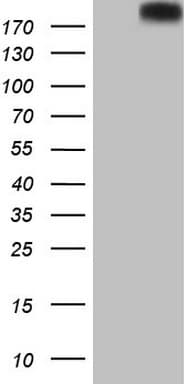 PTCH2 / Patched 2 Antibody (aa79-392, clone OTI1F5)