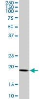 Monoclonal Mouse anti-Human ARF5 Antibody (clone 1B4, IF, WB)