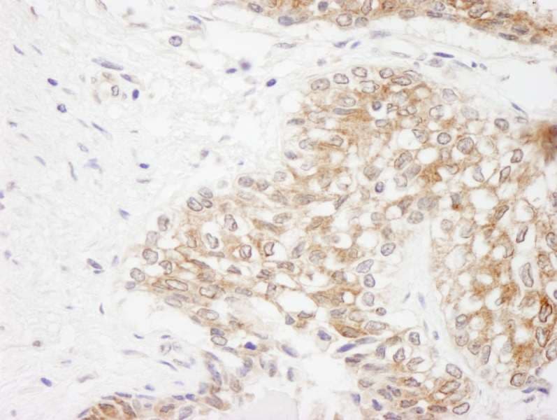 Polyclonal Rabbit anti-Human RICTOR Antibody (aa1650-C-term, IHC)