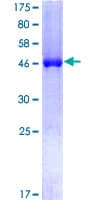 Human CSNK2B / Phosvitin Protein (Recombinant GST)