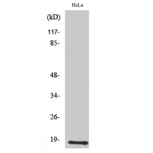 Polyclonal Rabbit anti-Human UBE2D2 / UBCH5B Antibody (70-150 aa, C-terminal, WB)