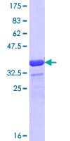 Human WASF1 / WAVE Protein (Recombinant GST, N-terminus)