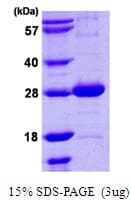 E. coli nth Protein (Recombinant His)