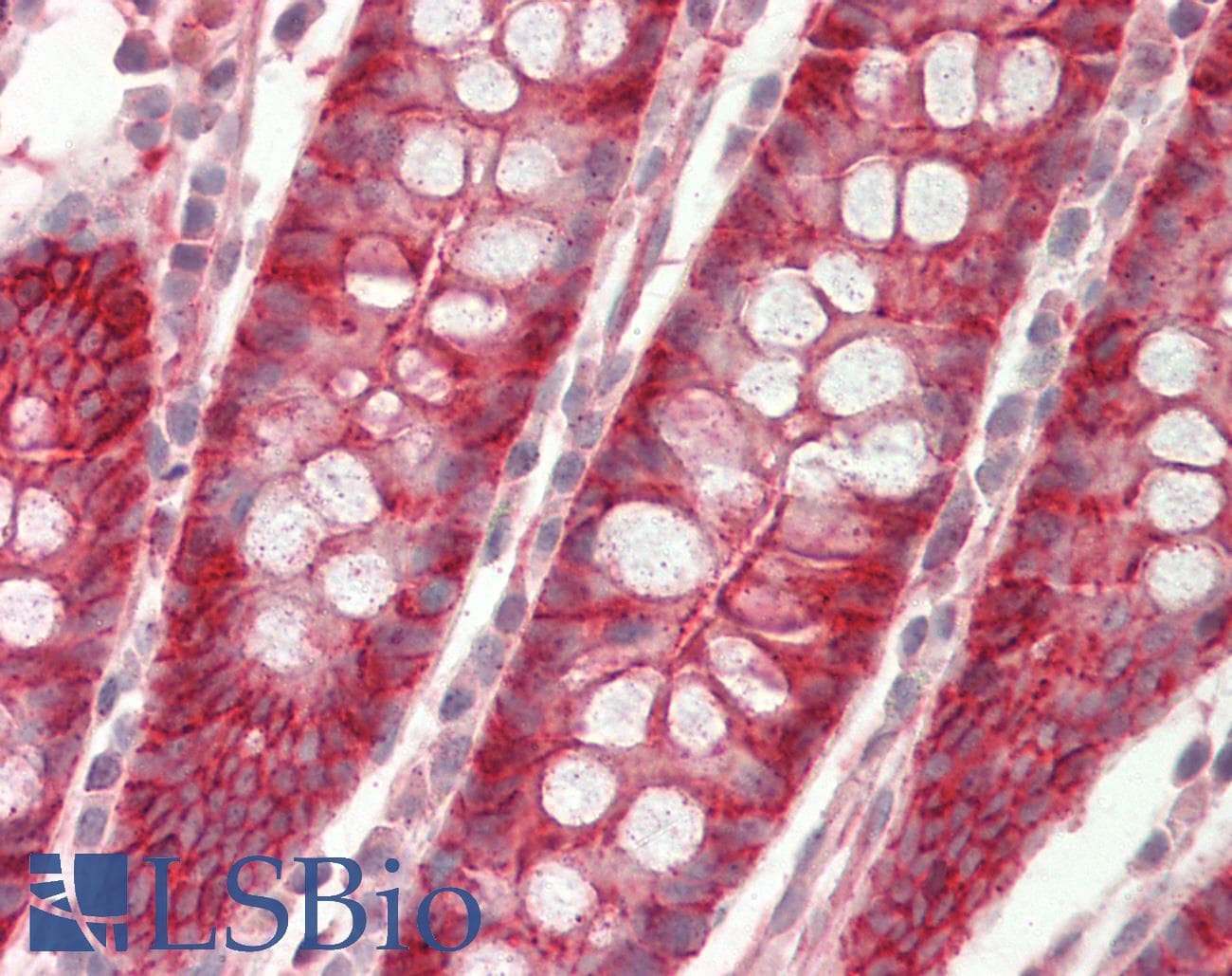 IHC-plus™ Polyclonal Rabbit anti-Chicken Cadherin Antibody (C-Terminus, IHC)
