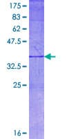 Human NTN1 / Netrin 1 Protein (Recombinant GST, N-terminus)