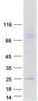 Human TUSC5 Protein (Recombinant Myc-DDK (Flag))