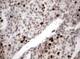 MKI67 / Ki67 Antibody (aa1160-1493, clone OTI5E6)
