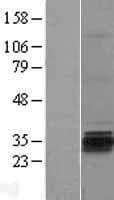 GSG1 Protein (Over-Expression Lysate Myc-DDK (Flag))