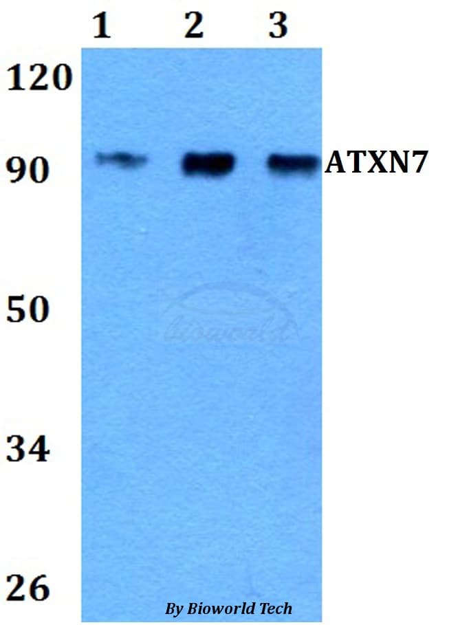 ATXN7 / SCA7 / Ataxin-7 Antibody