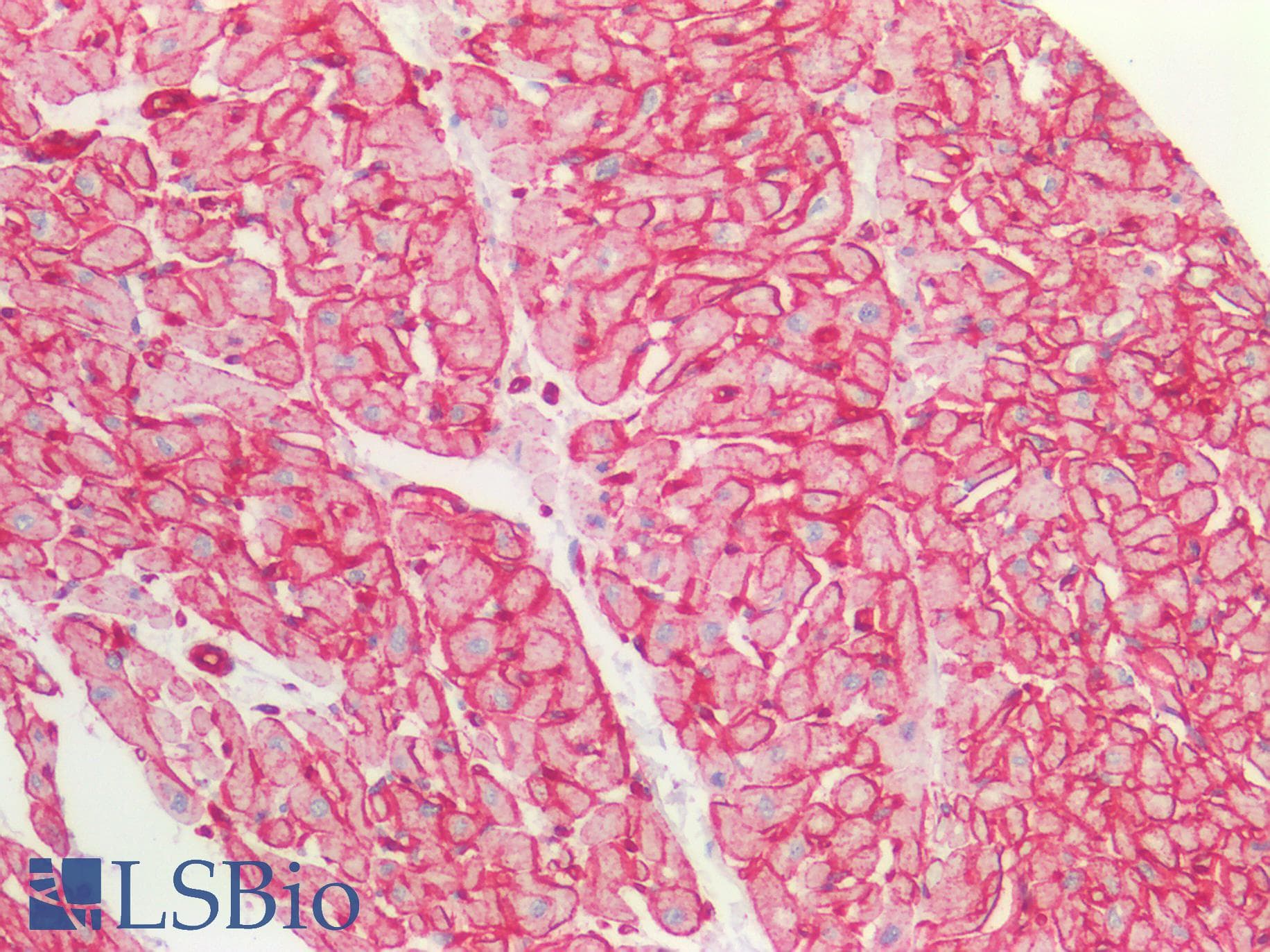 IHC-plus™ CAV1 / Caveolin 1 Antibody (aa129-178)