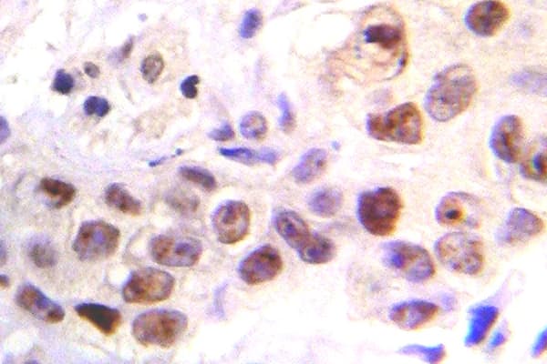 ATM Antibody (phospho-Ser1981)