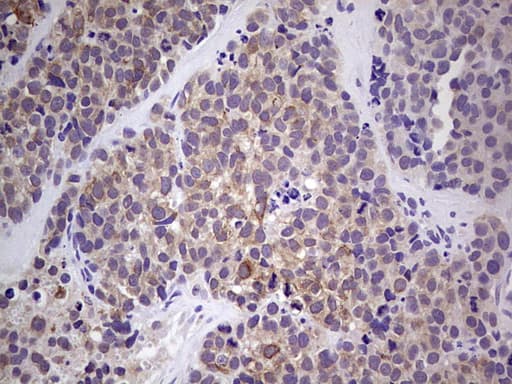 RET Antibody (aa713-1017, clone OTI5D4)