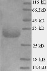 Pig EPO / Erythropoietin Protein (Recombinant 6His, N-terminus)