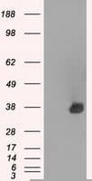AURKC / Aurora C Antibody (clone OTI10A7)
