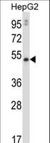 Polyclonal Rabbit anti-Human MMP20 Antibody (aa399-428, WB)