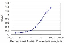 PDK4 Antibody (clone 1A9)
