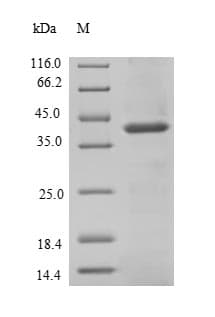 Human SIRPB1 / CD172b Protein (Recombinant 6His, N-terminus)