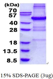 Human BCAP / PHF11 Protein (Recombinant His)