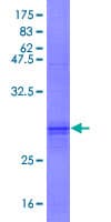 Human KIAA1147 Protein (Recombinant GST)