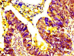 EPS8L3 Antibody