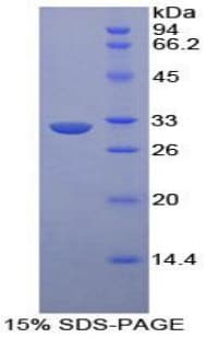 Human EPHA1 / EPH Receptor A1 Protein (Recombinant His-T7)