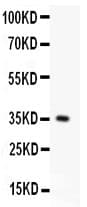 CD95 / FAS Antibody (aa26-173)