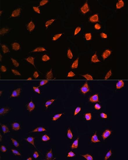 ART1 /CD296 Antibody