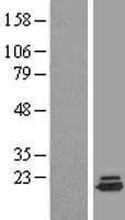 PPP1R27 / DYSFIP1 Protein (Over-Expression Lysate Myc-DDK (Flag))