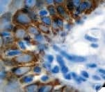 KRT14 / CK14 / Cytokeratin 14 Antibody (clone LL002)