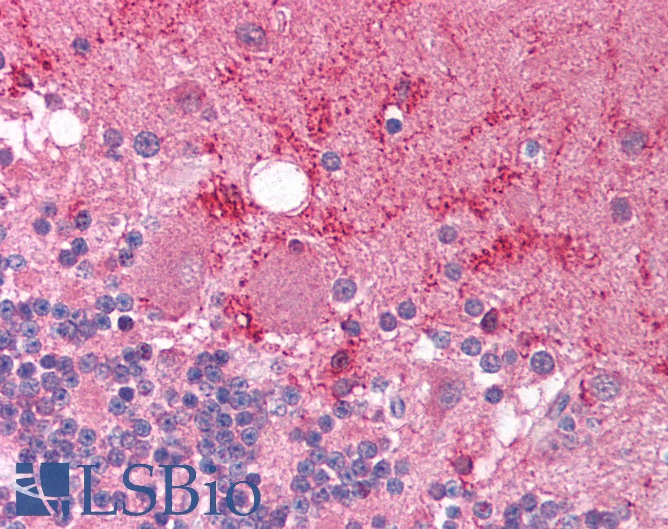 RCOR1 / COREST Antibody (C-Terminus)