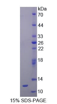 Rat REN / Renin 1 Protein (Recombinant His, N-Terminal)