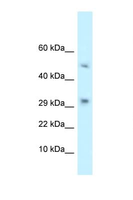 TCAIM Antibody (N-Terminus)