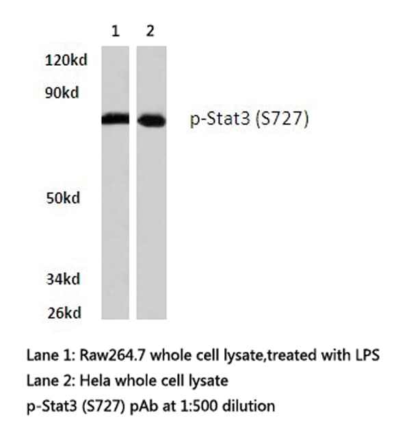 STAT3 Antibody (phospho-Ser727)