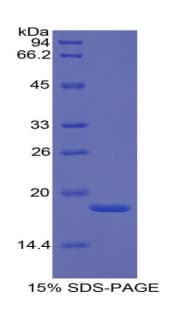 Human SELP / P-Selectin / CD62P Protein (Recombinant His)
