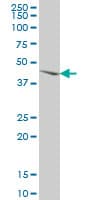 MKNK2 / MNK2 Antibody (clone 4F11)