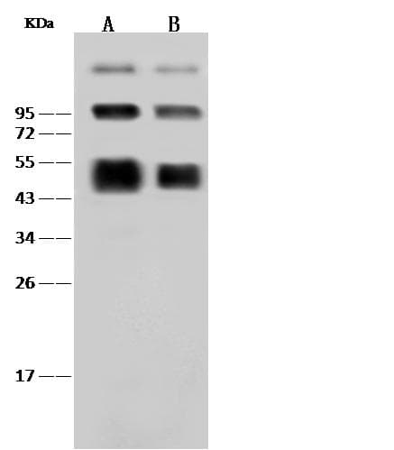 Dengue NS1 Antibody (Preservative Free)