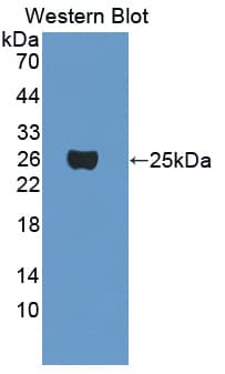 Crygf / Gamma F Crystallin Antibody (aa1-173)
