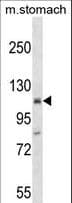 ST18 Antibody (aa195-222)