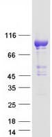 Human PDE11A Protein (Recombinant Myc-DDK (Flag))