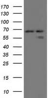 Alpha-Fetoprotein Antibody (clone OTI1D1)