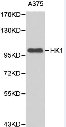 Polyclonal Rabbit anti-Human HK1 / Hexokinase 1 Antibody (IHC, WB)