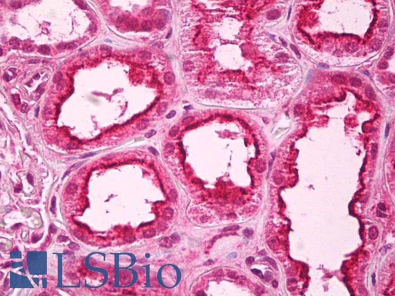 IHC-plus™ PPP1R10 / PNUTS Antibody