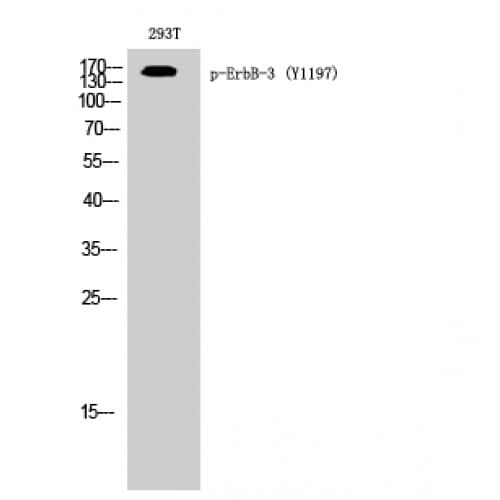 Polyclonal Rabbit anti-Human ERBB3 / HER3 Antibody (1140-1220 aa, WB)