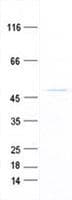 Human VRK3 Protein (Recombinant His, N-Terminal)